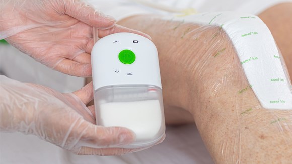 portable battery-powered pressure wound care system used on patient