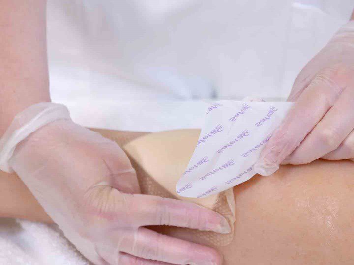 A photo of two hands putting a wound dressing on a wound.