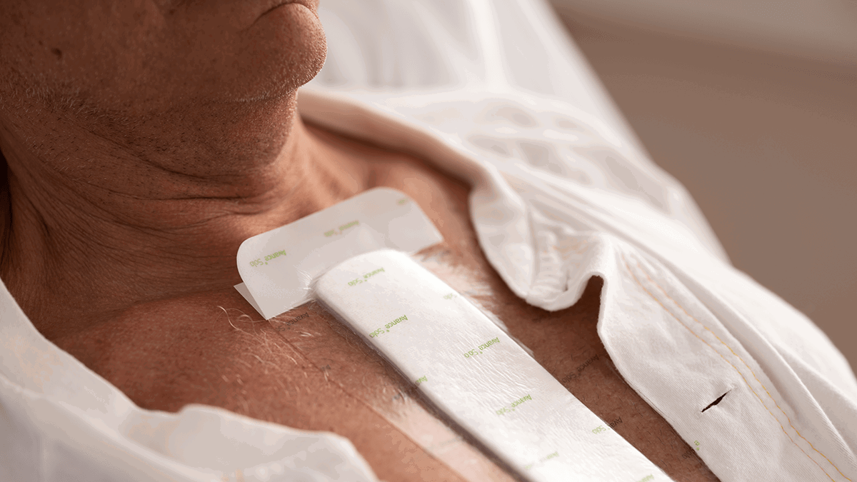 A photo of a chest wound dressing covering an incision wound. 