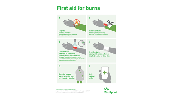 6 step guide on how to care for burns