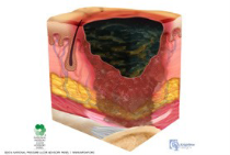 skin 12 