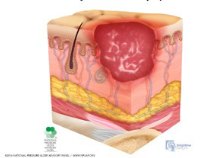 skin 7