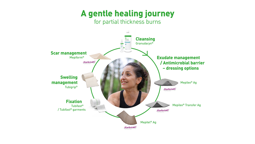 a gentle healing journey for burns