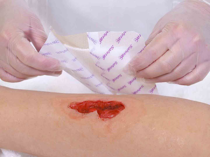 A photo of two hands holding a wound dressing over a wound.