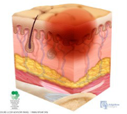 skin 5