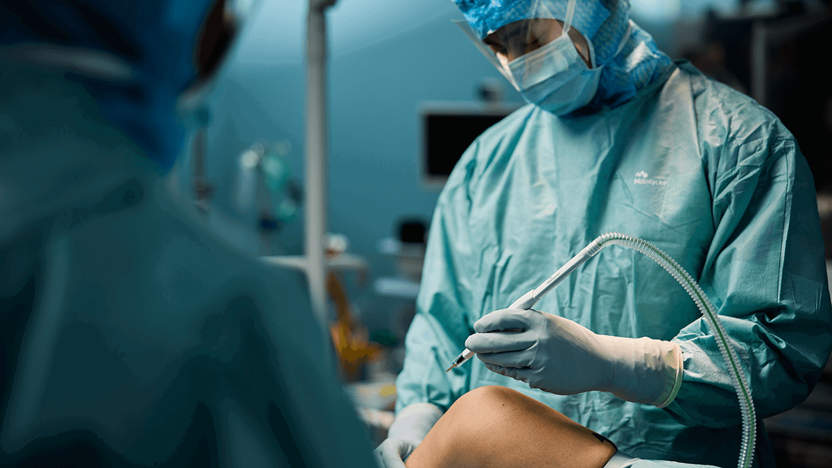 A photo of a surgeon using a plume evacuation pen on a knee.