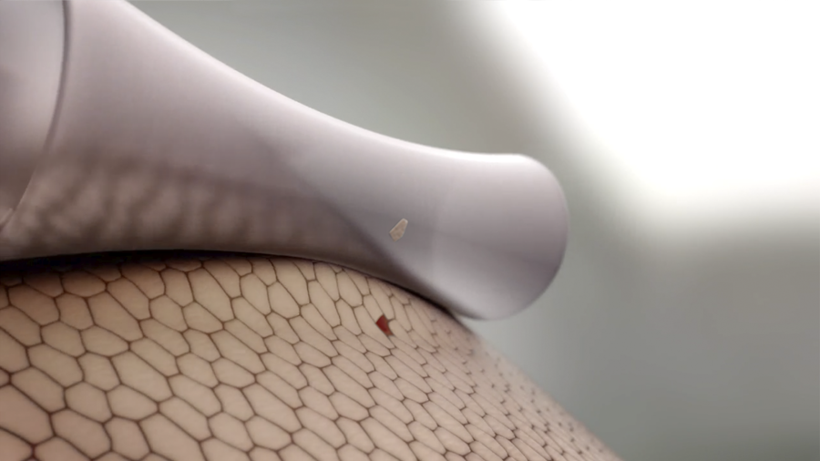 wound care