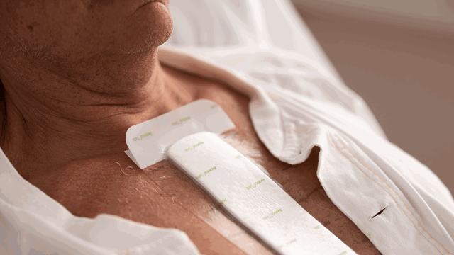 A photo of a chest wound dressing covering an incision wound. 