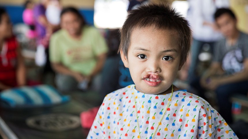 Une jeune fille philippine avant l'opération de sa fente labiale