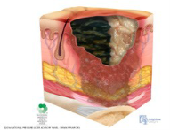 skin 11