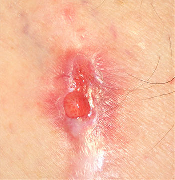 klar, transparent, bernsteingelb