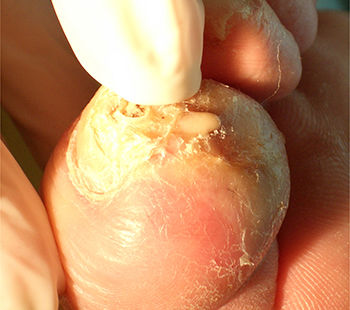 Milchig, trübe, cremefarben