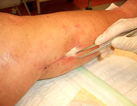 Abb.6: Non-Touch-Technik