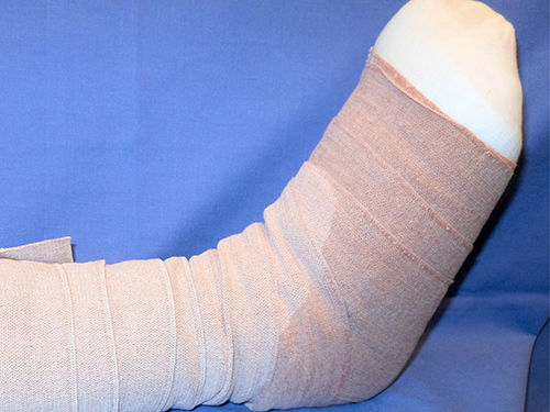 Abb. 1: v&ouml;llig durchn&auml;sster Verband im Fu&szlig;bereich