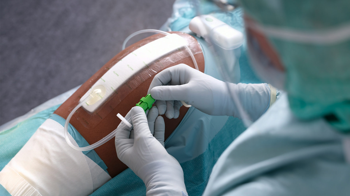 Avance Solo in Verwendung