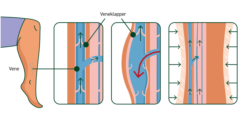 Illustation hvad sker der i benet?
