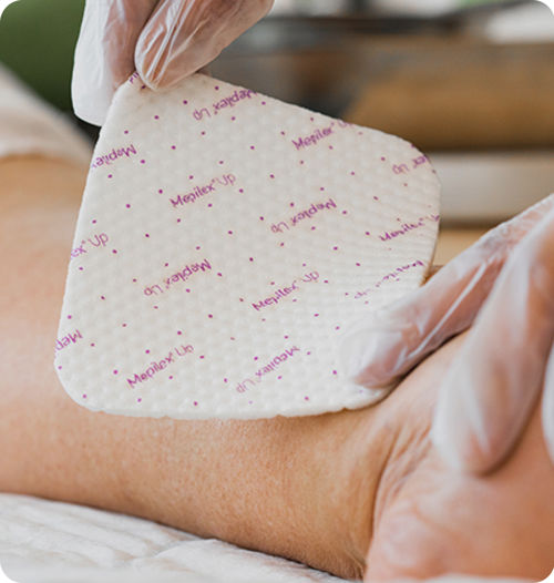 Healthcare professional applying Mepilex Up to leg