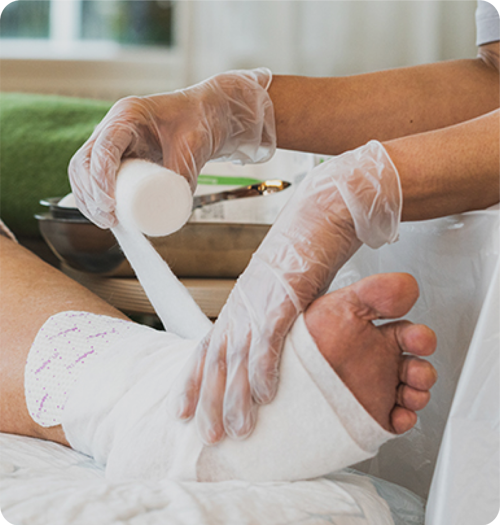 Healthcare professional applying compression over Mepilex Up silicone dressing
